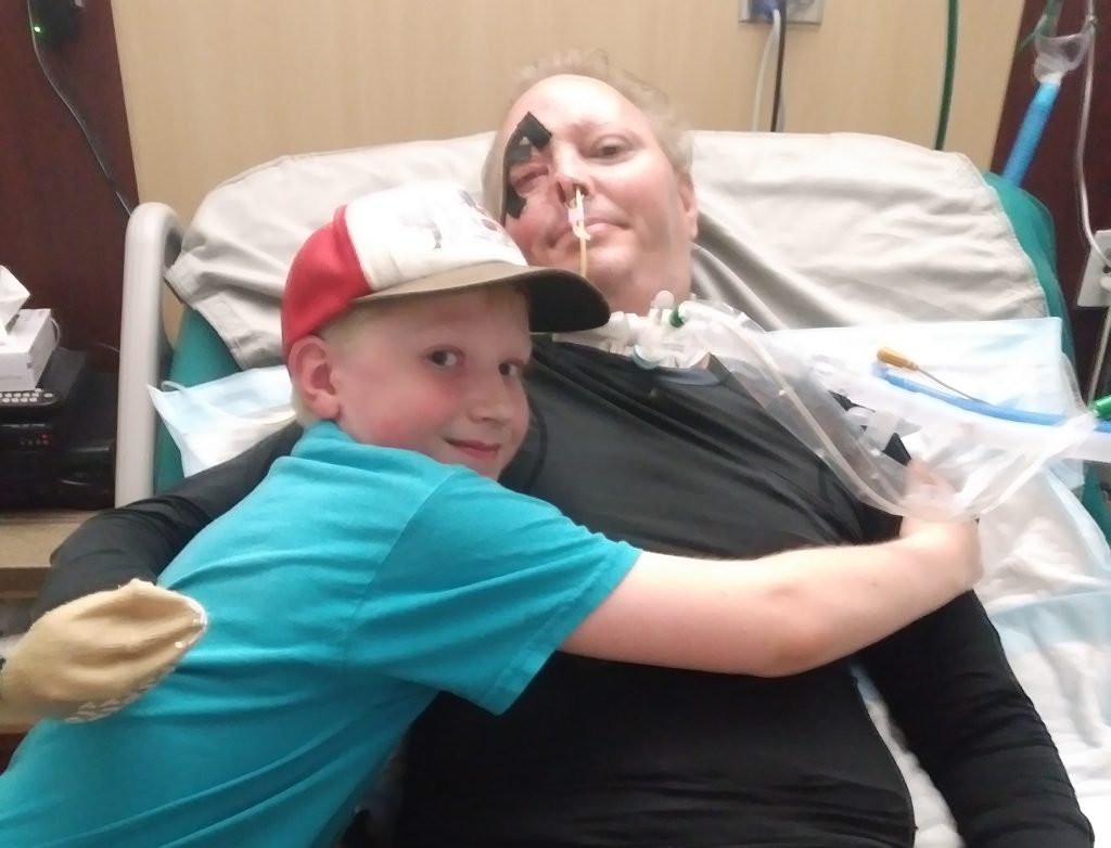 Utah Man Back From Brink After Freak Drag Racing Accident - KSLTV.com