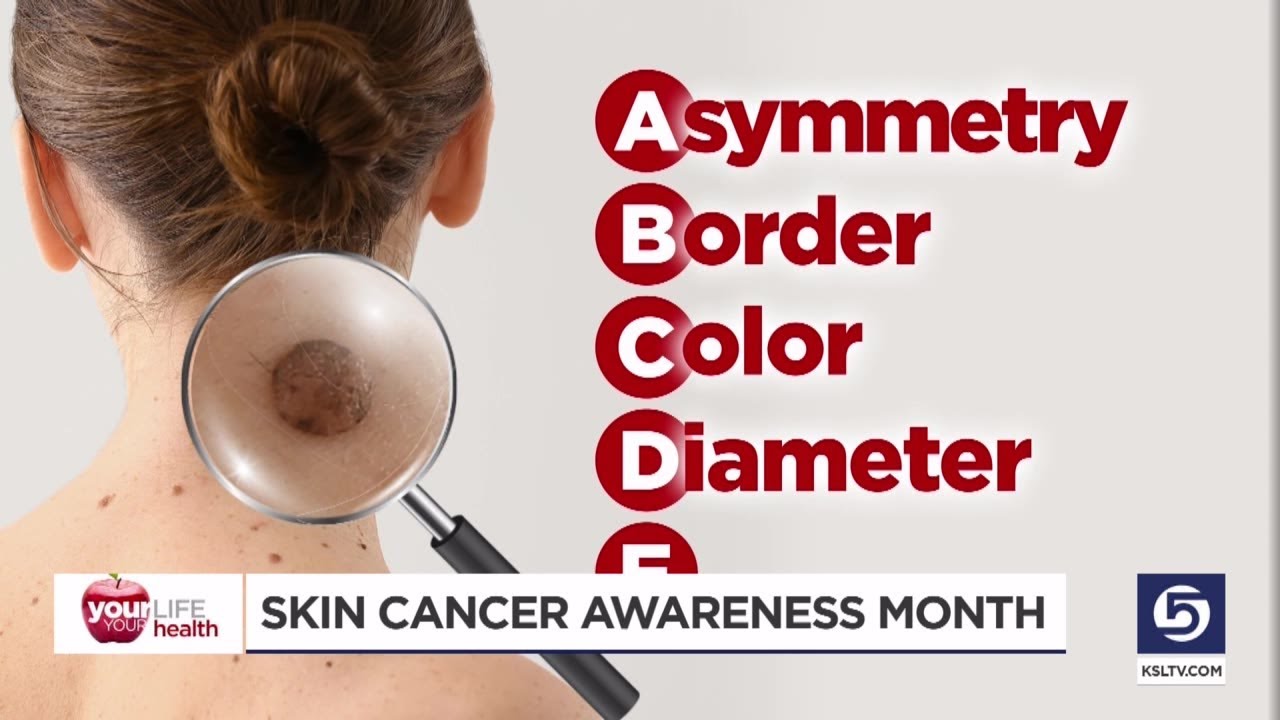Video: Sun safety reminders for Skin Cancer Awareness Month - KSLTV.com